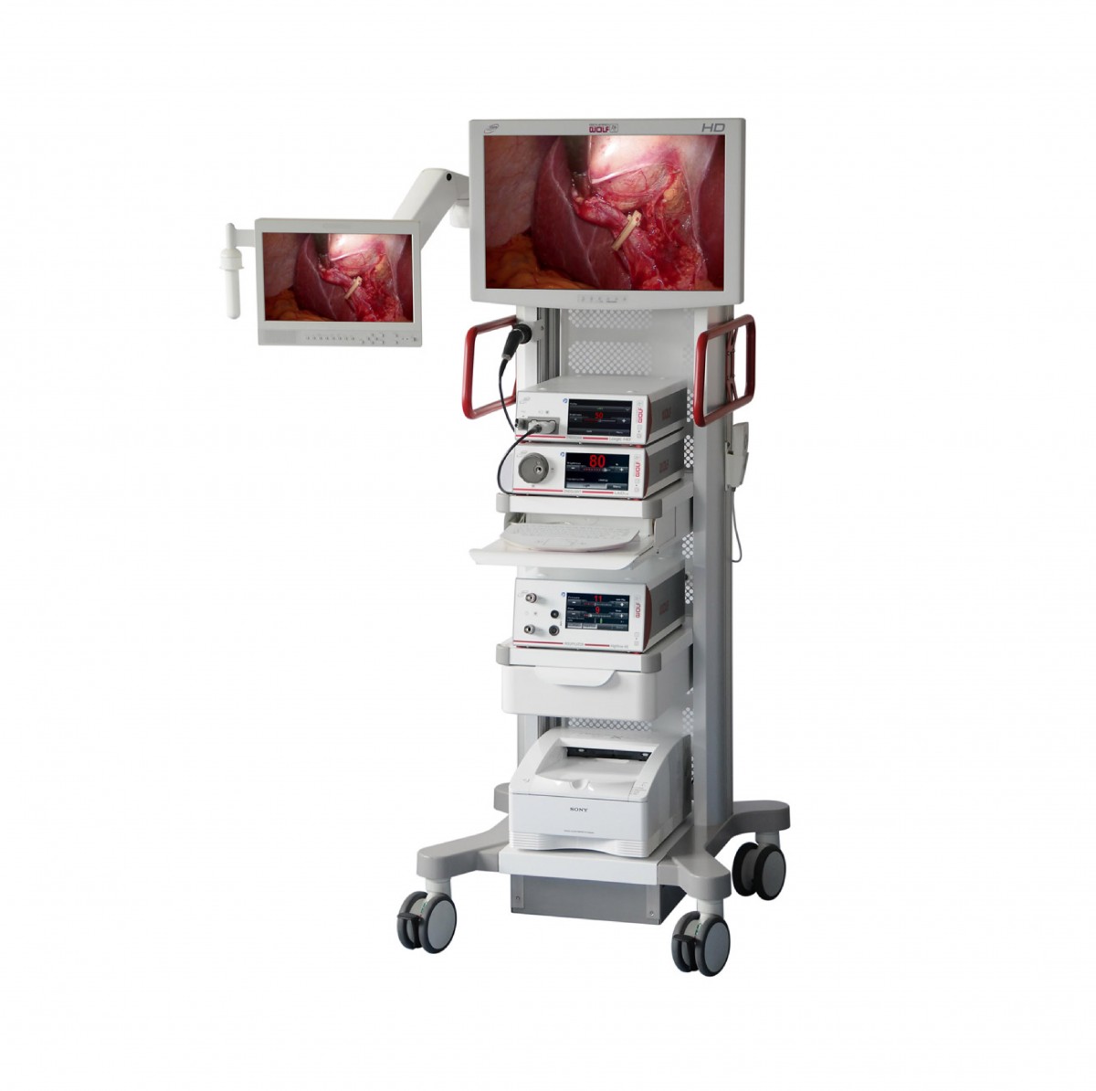 Endoscopy System TNT Medical